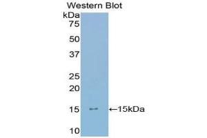 Western Blotting (WB) image for anti-Ly1 Antibody Reactive (LYAR) (AA 288-379) antibody (ABIN1859731) (LYAR anticorps  (AA 288-379))