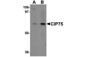 Western blot analysis of CIP75 in 3T3 cell lysate with AP30234PU-N CIP75 antibody at (A) 1 and (B) 2 μg/ml. (UBQLN4 anticorps  (N-Term))