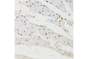 Immunohistochemistry of paraffin-embedded mouse heart using BAZ1B antibody.