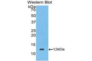 Western blot analysis of the recombinant protein. (TGFA anticorps  (AA 42-82))
