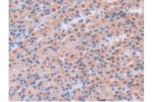 IHC-P analysis of Rat Stomach Tissue, with DAB staining. (Leptin anticorps  (AA 22-167))