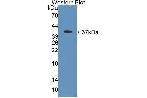 Western blot analysis of the recombinant protein. (PSG2 anticorps  (AA 35-335))