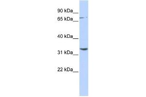 WB Suggested Anti-DPY19L1 Antibody Titration:  0. (DPY19L1 anticorps  (N-Term))