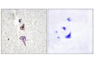Immunohistochemistry (IHC) image for anti-Mannose Receptor, C Type 2 (MRC2) (N-Term) antibody (ABIN1850036)