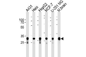 Western blot analysis of lysates from A431, Hela, HepG2, MCF-7, U-251 MG cell lines and mouse brain tissue lysate (from left to right), using CYC1 Antibody (Center) (ABIN1944852 and ABIN2838554). (Cytochrome C1 anticorps  (AA 142-176))