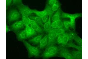 Immunocytochemistry/Immunofluorescence analysis using Mouse Anti-GABA A Receptor Monoclonal Antibody, Clone N151/3 (ABIN2485004).