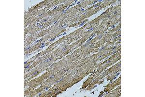 Immunohistochemistry of paraffin-embedded rat heart using MAP1B antibody (ABIN5971696) at dilution of 1/100 (40x lens). (MAP1B anticorps)