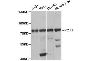 Western blot analysis of extracts of various cell lines, using POT1 antibody (ABIN2650945) at 1:1000 dilution. (POT1 anticorps)