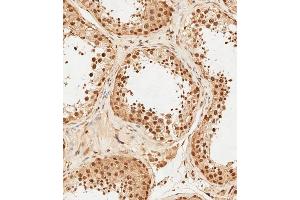 (ABIN6243826 and ABIN6578813) staining PSMD3 in human testis tissue sections by Immunohistochemistry (IHC-P - paraformaldehyde-fixed, paraffin-embedded sections).