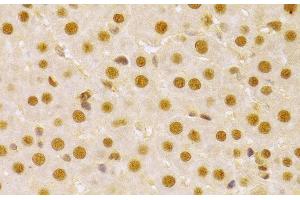 Immunohistochemistry of paraffin-embedded Rat liver using CDC25A Polyclonal Antibody at dilution of 1:100 (40x lens). (CDC25A anticorps)
