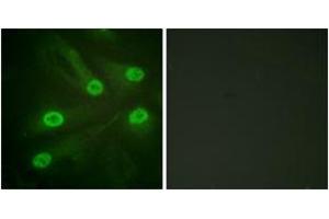 Immunofluorescence analysis of HeLa cells, using p53 (Acetyl-Lys386) Antibody. (p53 anticorps  (acLys386))