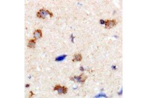 Immunohistochemical analysis of Dynamin 1 staining in human brain formalin fixed paraffin embedded tissue section.