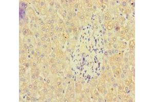 Immunohistochemistry of paraffin-embedded human liver tissue using ABIN7162471 at dilution of 1:100
