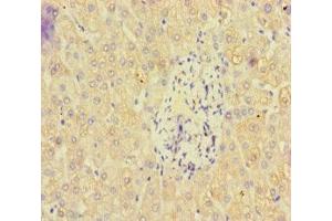 Immunohistochemistry of paraffin-embedded human liver tissue using ABIN7162471 at dilution of 1:100 (PAN2 anticorps  (AA 628-908))