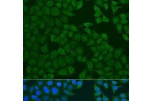 Immunofluorescence analysis of U2OS cells using FERMT3 Polyclonal Antibody at dilution of 1:100. (FERMT3 anticorps)