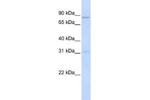 WB Suggested Anti-POMT1 Antibody Titration:  0. (POMT1 anticorps  (Middle Region))