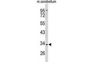 Western blot analysis of Peroxin 2 / PEX2 / RNF72 (arrow) in mouse cerebellum tissue lysates (35ug/lane) using Peroxin 2 / PEX2 / RNF72 