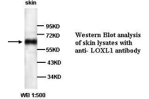 Image no. 1 for anti-Lysyl Oxidase-Like 1 (LOXL1) antibody (ABIN790875)