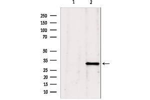 Western blot analysis of extracts from Mouse Myeloma cell, using GNMT antibody. (GNMT anticorps  (Internal Region))
