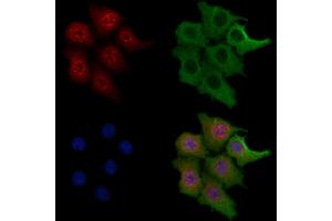 ABIN6265278 and ABIN6269141 staining HepG2 cells by IF/ICC.