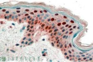 Image no. 1 for anti-Stratifin (SFN) (Internal Region), (N-Term) antibody (ABIN374638) (14-3-3 sigma/SFN anticorps  (Internal Region, N-Term))