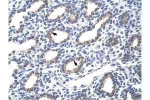 Cytokeratin 18 antibody was used for immunohistochemistry at a concentration of 4-8 ug/ml to stain Alveolar cells (arrows) in Human Lung. (Cytokeratin 18 anticorps  (N-Term))