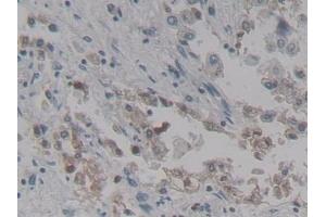 Detection of SPD in Human Lung Tissue using Polyclonal Antibody to Surfactant Associated Protein D (SPD)