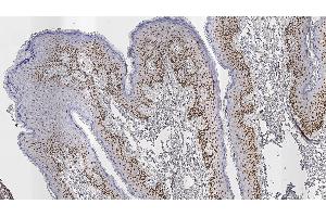 Human skin: immunohistochemical staining for Androgen Receptor.