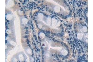 Detection of GDF5 in Human Stomach Tissue using Polyclonal Antibody to Growth Differentiation Factor 5 (GDF5)