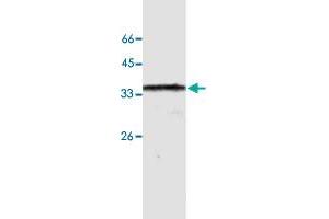 Western blot analysis of HeLa whole cell lystae with ANXA10 monoclonal antibody, clone 24  at 1:500 dilution. (Annexin a10 anticorps  (AA 168-324))