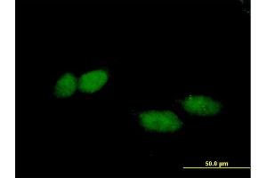 Immunofluorescence of purified MaxPab antibody to TBL1X on HeLa cell. (TBL1X anticorps  (AA 1-526))