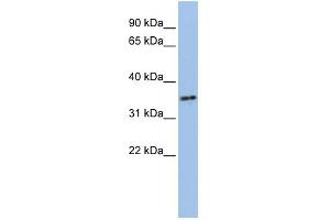 WB Suggested Anti-PHF13 Antibody Titration:  0. (PHF13 anticorps  (N-Term))
