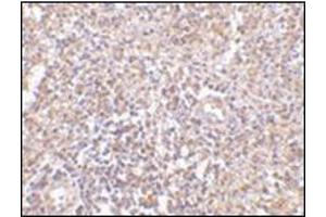 Immunohistochemistry of RAP80 in human spleen tissue with this product at 2.