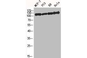 Western Blot analysis of MCF7 PC-3 KB HELA cells using BM28 Polyclonal Antibody (MCM2 anticorps  (N-Term))
