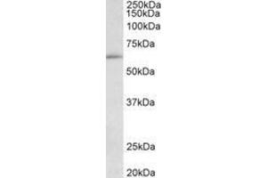 Image no. 1 for anti-Hypermethylated in Cancer 2 (HIC2) (AA 188-200) antibody (ABIN1102028) (HIC2 anticorps  (AA 188-200))
