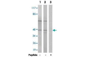 Western blot analysis of extracts from COLO cells (Lane 1 and lane 3) and Jurkat cells (Lane 2), using CCNE2 polyclonal antibody . (Cyclin E2 anticorps)