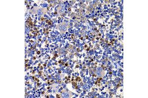 Immunohistochemistry of paraffin-embedded rat spleen using STAMBP antibody at dilution of 1:100 (x400 lens). (STAMBP anticorps)