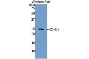 Western blot analysis of the recombinant protein. (FBLN2 anticorps  (AA 858-1069))