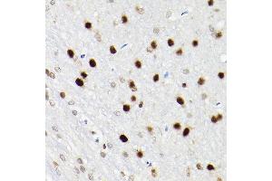 Immunohistochemistry of paraffin-embedded rat brain using S Rabbit pAb (ABIN6130296, ABIN6147396, ABIN6147398 and ABIN6221485) at dilution of 1:200 (40x lens).