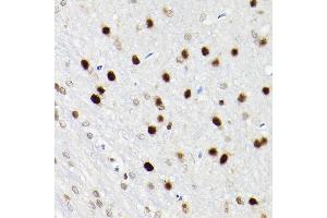 Immunohistochemistry of paraffin-embedded rat brain using S Rabbit pAb (ABIN6130296, ABIN6147396, ABIN6147398 and ABIN6221485) at dilution of 1:200 (40x lens). (SATB1 anticorps  (AA 484-763))
