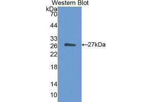 Western Blotting (WB) image for anti-Cholesteryl Ester Transfer Protein (CETP) (AA 81-311) antibody (ABIN1173657) (CETP anticorps  (AA 81-311))