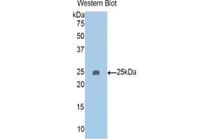 Western blot analysis of the recombinant protein. (PAPPA2 anticorps  (AA 888-1093))