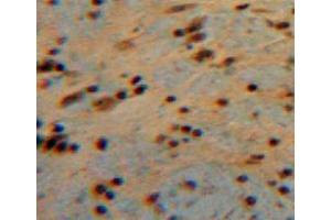 Used in DAB staining on fromalin fixed paraffin-embedded brain tissue (CNTF anticorps  (AA 2-200))