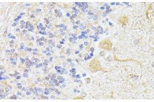 Immunohistochemistry of paraffin-embedded Rat cerebellum using ELP3 Polyclonal Antibody at dilution of 1:100 (40x lens). (ELP3/KAT9 anticorps)