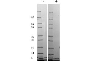 SDS-PAGE of Mouse Gro-alpha /KC (CXCL1) Recombinant Protein SDS-PAGE of Mouse Gro-alpha /KC (CXCL1) Recombinant Protein.