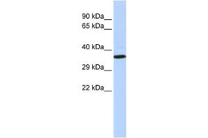 WB Suggested Anti-NKX2-2 Antibody Titration:  0. (Nkx2-2 anticorps  (N-Term))