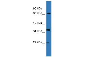 WB Suggested Anti-DOK4 Antibody Titration: 0. (DOK4 anticorps  (N-Term))