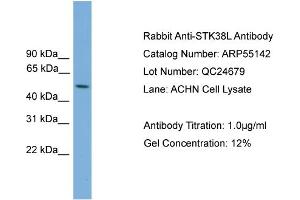 WB Suggested Anti-STK38L  Antibody Titration: 0. (STK38L anticorps  (Middle Region))
