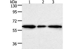 Western Blot analysis of Human liver cancer tissue, hela and 293T cell using AKR1A1 Polyclonal Antibody at dilution of 1:500 (AKR1A1 anticorps)