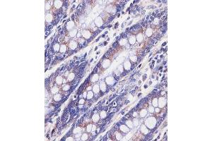 staining BPC3 in human colon tissue sections by Immunohistochemistry (IHC-P - raformaldehyde-fixed, raffin-embedded sections). (PABPC3 anticorps  (AA 84-117))
